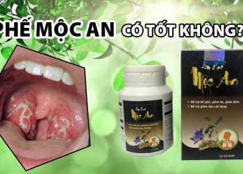 an phế mộc an có tốt không