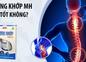 xương khớp mh có tốt không