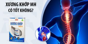 xương khớp mh có tốt không