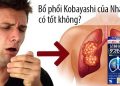 viên bổ phổi kobayashi có tốt không