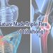bổ khớp nature made triple flex có tốt không