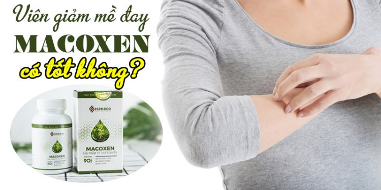 hinh dai dien macoxen co tot khong