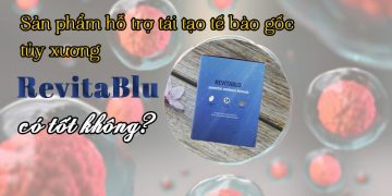 hinh dai dien revitablu co tot khong
