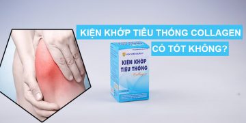 kiện khớp tiêu thống collagen có tốt không