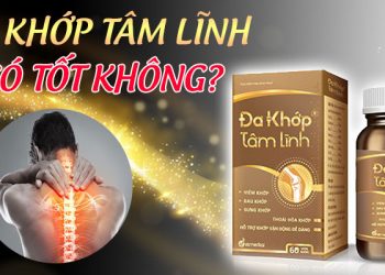 [CHI TIẾT] Viên Uống Đa Khớp Tâm Lĩnh Có Tốt Không?