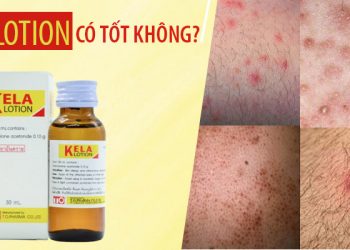 kela lotion có tốt không