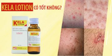 kela lotion có tốt không