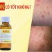 kela lotion có tốt không