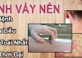 bệnh vẩy nến